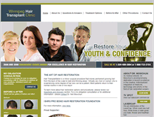 Tablet Screenshot of hairtransplantcanada.com